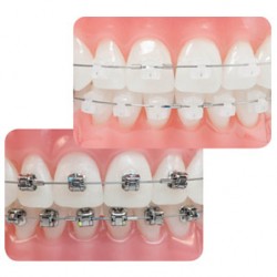 Clínica Dental Poniente Ortodoncia 1