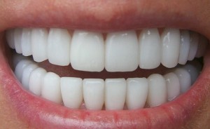 Clínica Dental Poniente Periodoncia